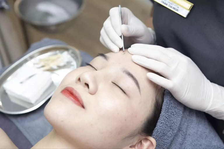 bị mụn nên đi da liễu hay đi spa