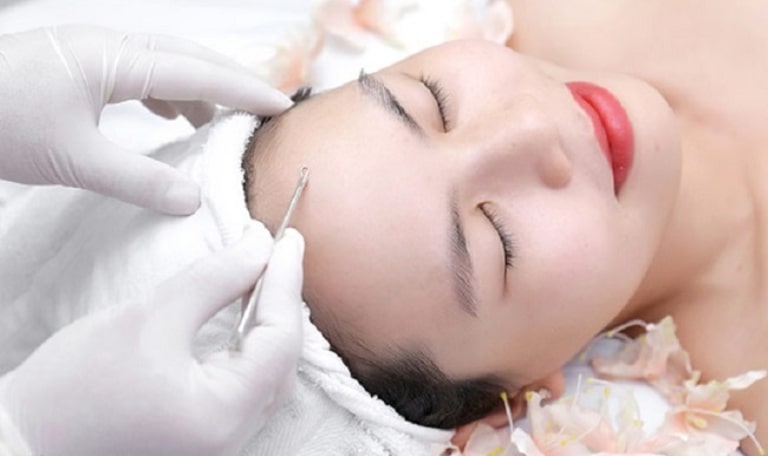 trị mụn bình tân
