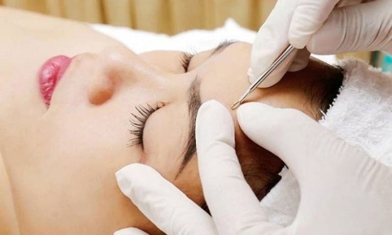 giá lấy nhân mụn tại spa